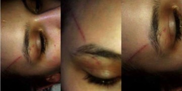 Ελλάς-Βία-Ομοφοβία