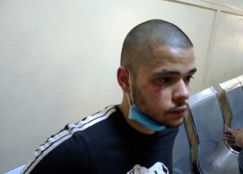 Η ΕΛΑΣ χτύπησε τον 18χρονο κατά τη σύλληψή του (φώτο)