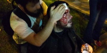 Δίωξη Κώστα Ξενόπουλου: Σε δίκη στις 9/2 γιατί τα ΜΑΤ του «άνοιξαν» το κεφάλι!