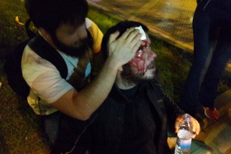 Δίωξη Κώστα Ξενόπουλου: Σε δίκη στις 9/2 γιατί τα ΜΑΤ του «άνοιξαν» το κεφάλι!