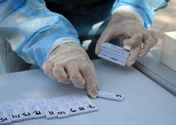 Ο Δήμος Αθήνας διακόπτει τα δωρεάν rapid test στις 8 Λέσχες Φιλίας