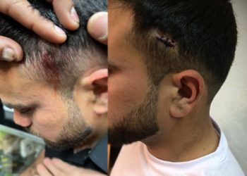 Φασίστας πυροβόλησε στα Πατήσια μουσουλμάνους μετανάστες εργάτες