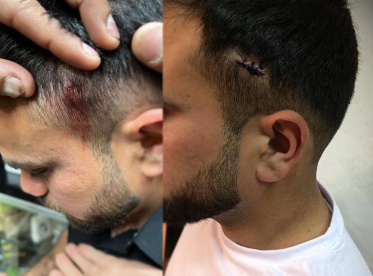 Φασίστας πυροβόλησε στα Πατήσια μουσουλμάνους μετανάστες εργάτες