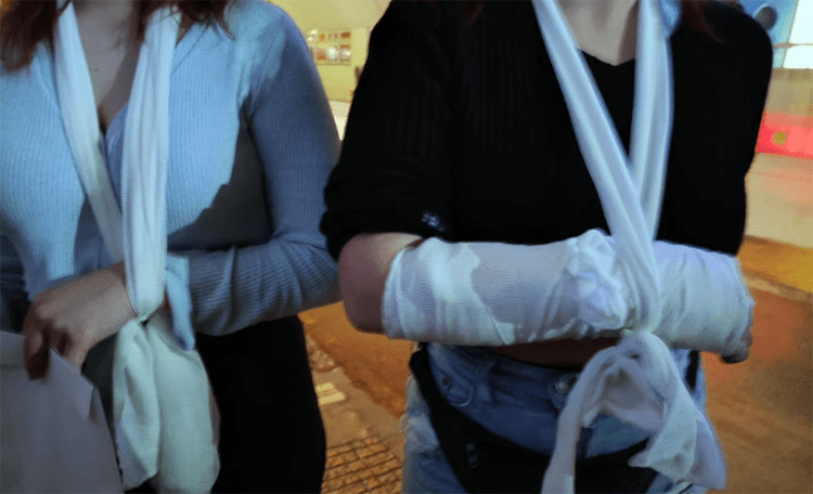 Βίαιη αστυνομική επίθεση με γκλοπ, ασπίδες και χημικά σε φεμινιστική διαμαρτυρία (βίντεο)