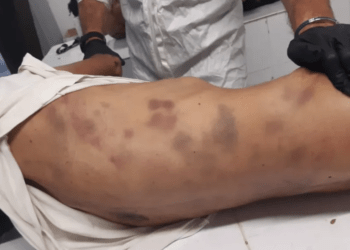 Οργή και διαδηλώσεις για τη δολοφονία του μετανάστη Μοχάμεντ Καμράν στο Α.Τ. Αγίου Παντελεήμονα