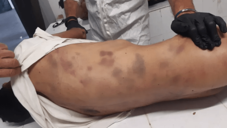 Οργή και διαδηλώσεις για τη δολοφονία του μετανάστη Μοχάμεντ Καμράν στο Α.Τ. Αγίου Παντελεήμονα