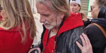 Μια ακόμη δολοφονική επίθεση των ΜΑΤ στον Μάριο Λώλο