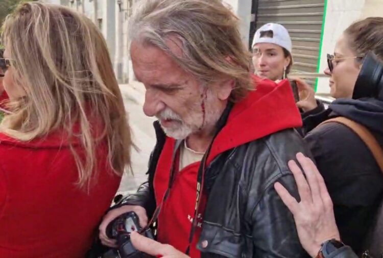 Μια ακόμη δολοφονική επίθεση των ΜΑΤ στον Μάριο Λώλο