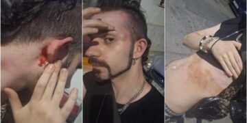 νΚΑ: Καμιά ανοχή στις ομοφοβικές επιθέσεις και τη βία ενάντια στα queer άτομα