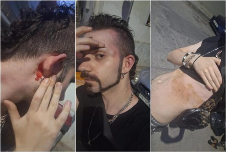 νΚΑ: Καμιά ανοχή στις ομοφοβικές επιθέσεις και τη βία ενάντια στα queer άτομα