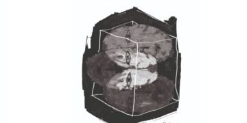 «Μάλινα» της Ίνγκεμποργκ Μπάχμαν